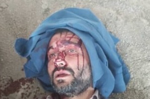 مجروح شدن شهردار ناحیه ۳ منطقه ۱۹ با ضربات چاقو هنگام ماموریت